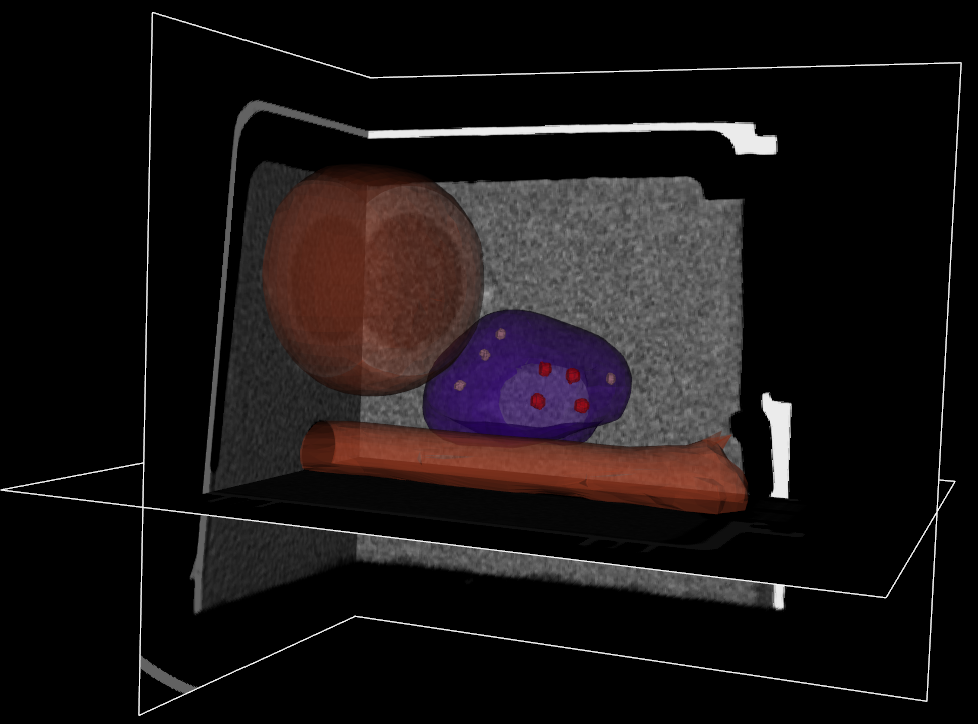 CT dataset 6 surfaces with 4 1mm-diameter and 4 2mm-diameter markers png.Semi-custom Prostate Phantom