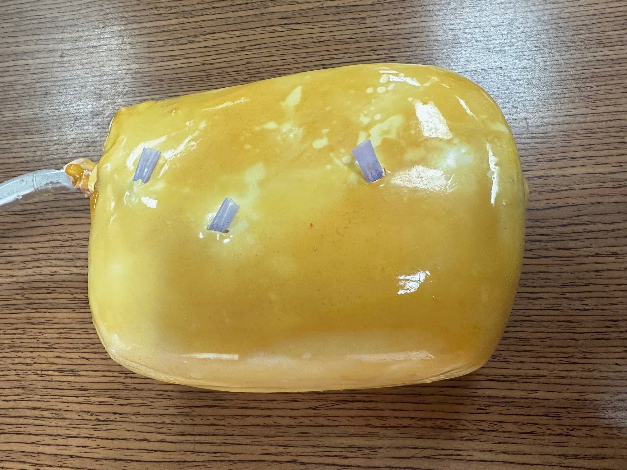 FIGURE1-KIDNEY.gif An Ultrasound Training Tool for Removing Kidney Stones