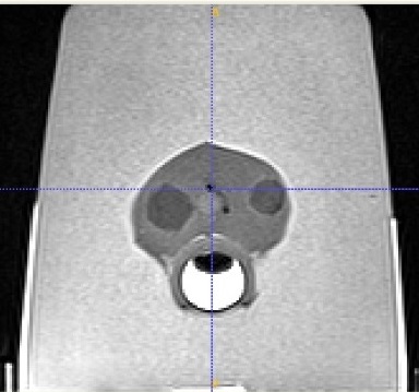 Image of 2 bead markers in MRI modality.Custom Prostate Phantom