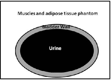 Schematic of bladder scanner phantom image