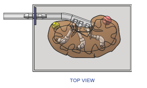 FIGURE2-LIVER-TOP-VIEW.png