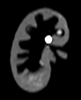Kidney Phantom CT Image 1