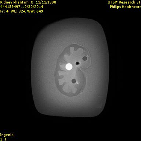 Kidney Phantom MRI Image 1