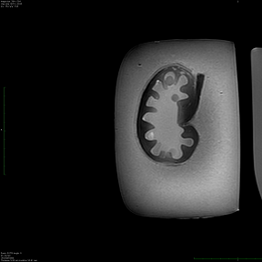 Kidney Phantom MRI Image 2
